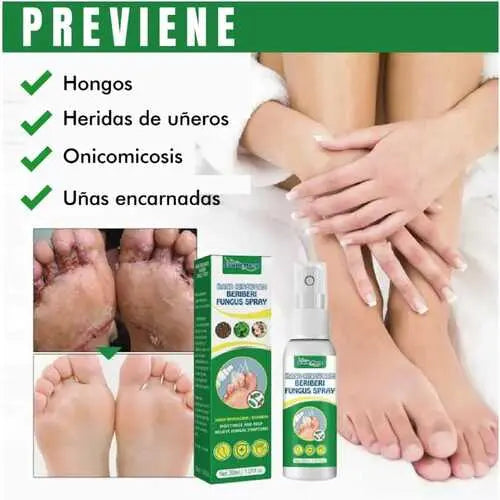 Deshazte del hongo en tus pies/Spray antifúngico de acción rápida